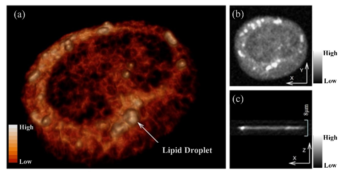 长春光机所在活细胞自发-受激拉曼双模态空间共定位自动检测技术取得进展